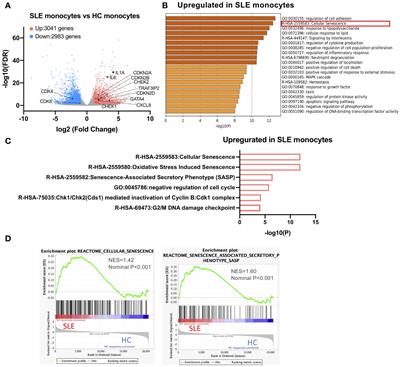 Enhanced GATA4 expression in senescent systemic lupus erythematosus monocytes promotes high levels of IFNα production